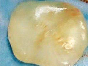 女婴带玉出生 天降“水球” 神之宠儿?