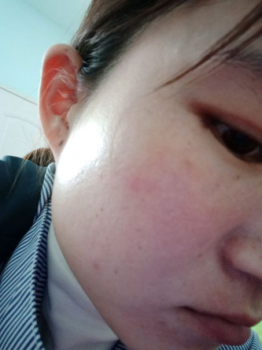 �к�Ѫ˿��ʲô��Ĥ��?����Ѫ˿��Ĥ�ع��ʳ���