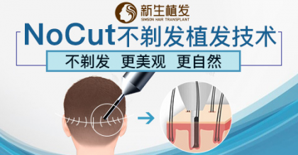 ��������ֲ��NoCut���귢ֲ��������ֲ��Ч�������۸���Ȼ