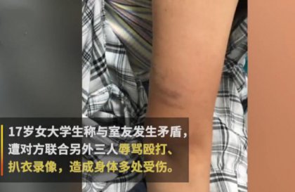 �����Ѱ���¼�� У԰�����쾯��ͨ��