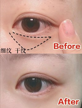 27�걣�������Ƶ��ؼ�!��Ҫ��Ů���⼸������һ����Ҫ�ٲ���