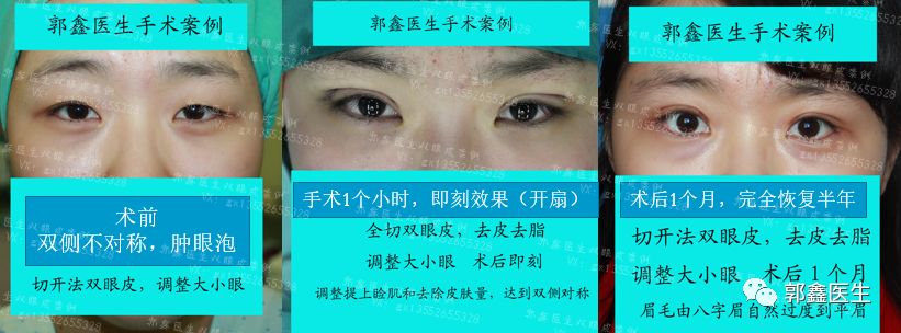 ����鿴ԭʼͼƬ