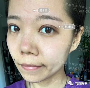 ����鿴ԭʼͼƬ