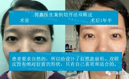 ����鿴ԭʼͼƬ